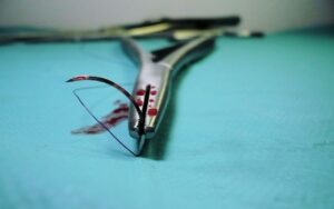 surgery, tools, vice-1662206.jpg